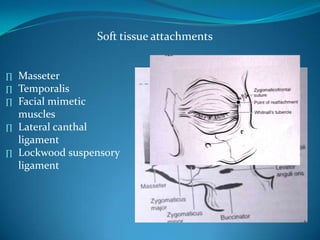 Soft tissue attachments
∏ Masseter
∏ Temporalis
∏ Facial mimetic
muscles
∏ Lateral canthal
ligament
∏ Lockwood suspensory
ligament
 