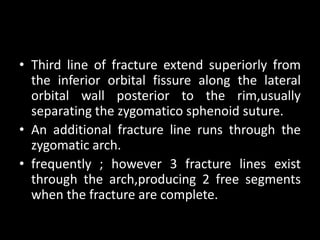• Third line of fracture extend superiorly from
the inferior orbital fissure along the lateral
orbital wall posterior to the rim,usually
separating the zygomatico sphenoid suture.
• An additional fracture line runs through the
zygomatic arch.
• frequently ; however 3 fracture lines exist
through the arch,producing 2 free segments
when the fracture are complete.
 