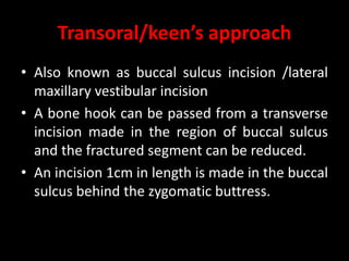Transoral/keen’s approach
• Also known as buccal sulcus incision /lateral
maxillary vestibular incision
• A bone hook can be passed from a transverse
incision made in the region of buccal sulcus
and the fractured segment can be reduced.
• An incision 1cm in length is made in the buccal
sulcus behind the zygomatic buttress.
 