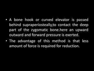 • A bone hook or curved elevator is passed
behind supraperiosteally,to contact the deep
part of the zygomatic bone.here an upward
outward and forward pressure is exerted.
• The advantage of this method is that less
amount of force is required for reduction.
 