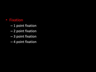 • Fixation
– 1 point fixation
– 2 point fixation
– 3 point fixation
– 4 point fixation
 