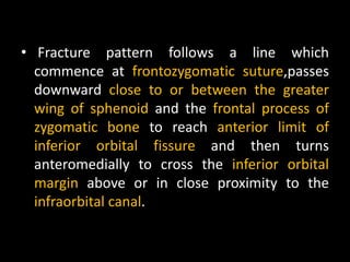 • Fracture pattern follows a line which
commence at frontozygomatic suture,passes
downward close to or between the greater
wing of sphenoid and the frontal process of
zygomatic bone to reach anterior limit of
inferior orbital fissure and then turns
anteromedially to cross the inferior orbital
margin above or in close proximity to the
infraorbital canal.
 