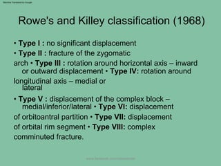 Rhowe Classification zygomaticomaxillarycomplexfracture-150906015841-lva1-app6892 (1).pdf