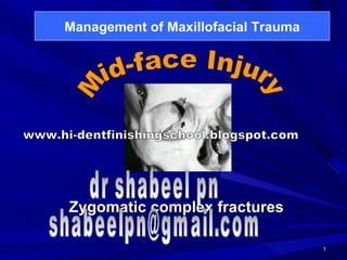 Zygomatic complex fractures Mid-face Injury Management of Maxillofacial Trauma dr shabeel pn [email_address] www.hi-dentfinishingschool.blogspot.com 