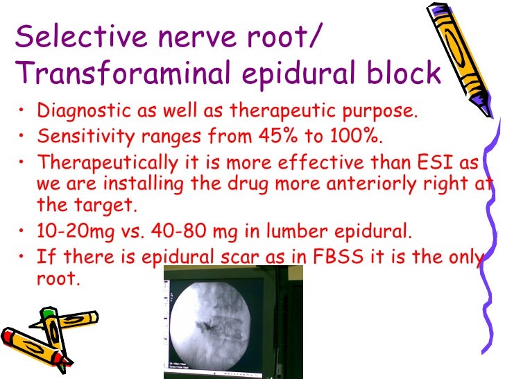 Interventional Pain Management