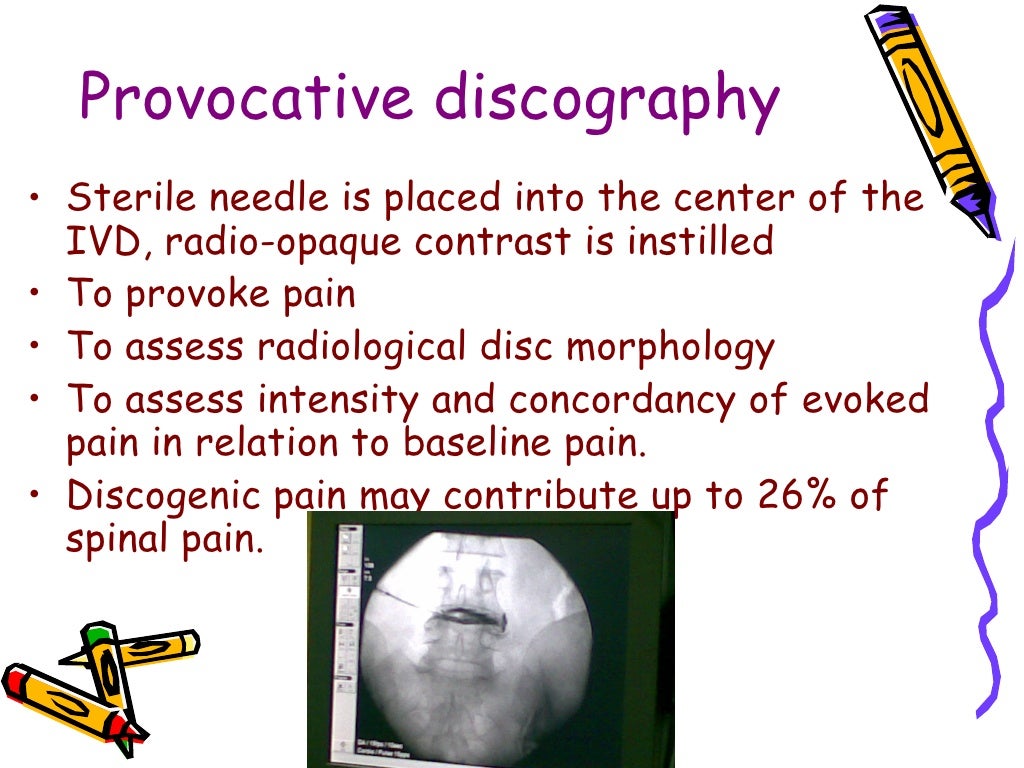 Interventional Pain Management