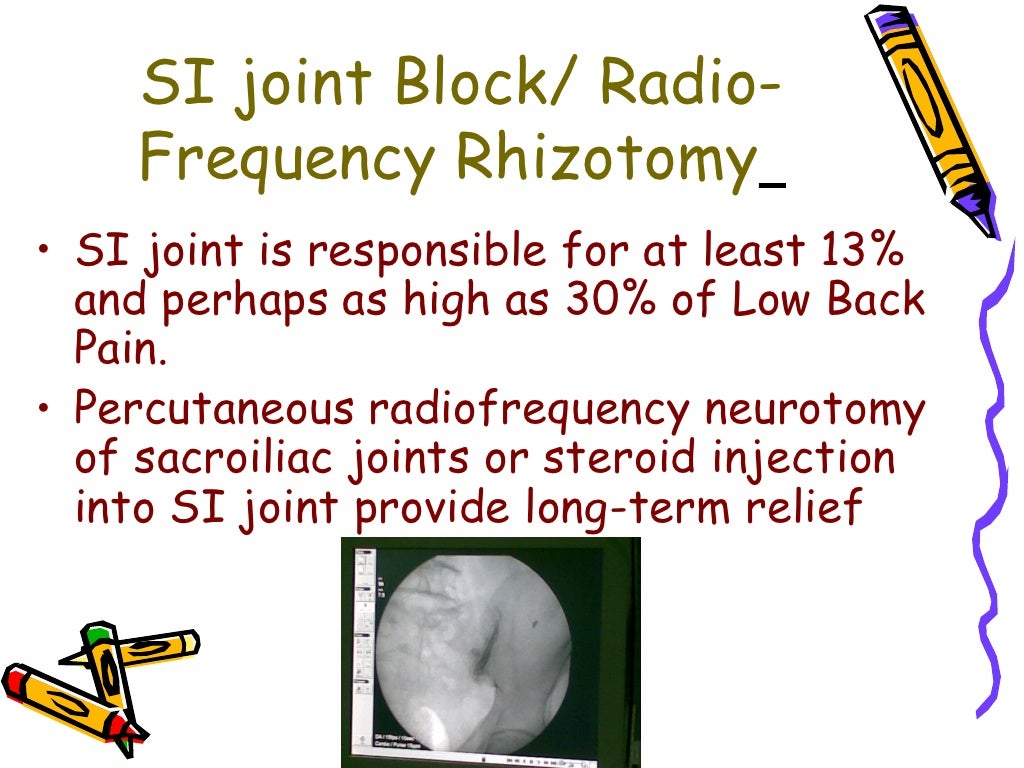 Interventional Pain Management